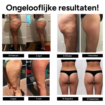 Lievea 3D Anti-Cellulite Legging